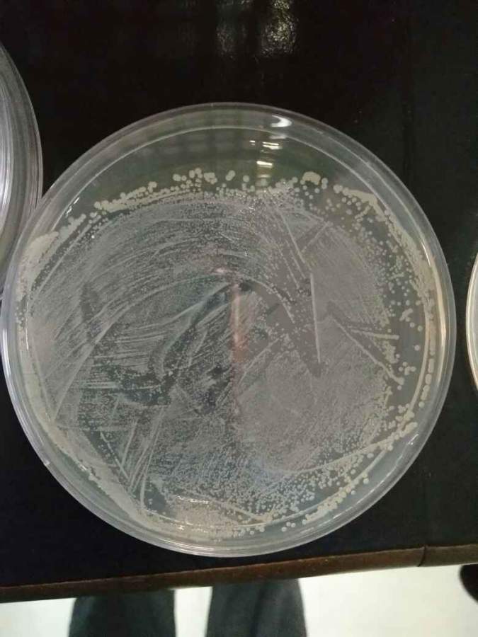 酵母菌稀释涂布平板法图片