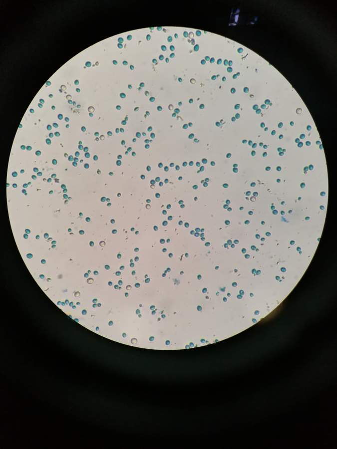 亚甲基蓝染色酵母细胞图片