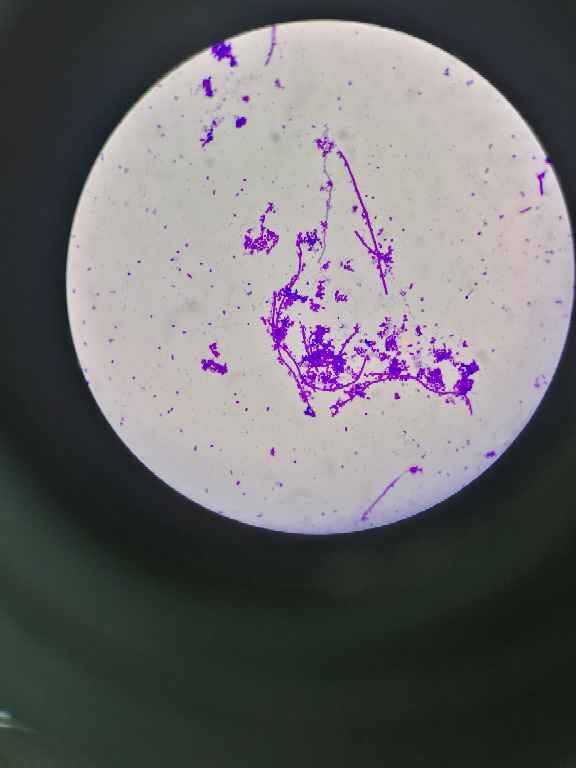 大肠杆菌镜检图片