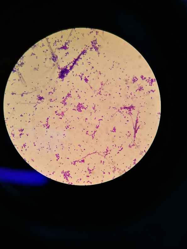 链杆菌显微镜下图片图片