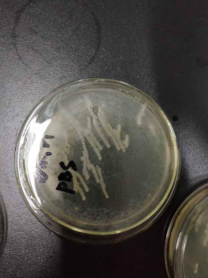 涂布平板时菌落聚集在一起