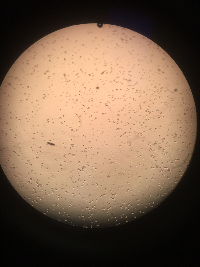 293f悬浮细胞生长是否正常-1